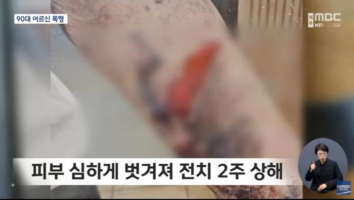 MBC 보도 갈무리
